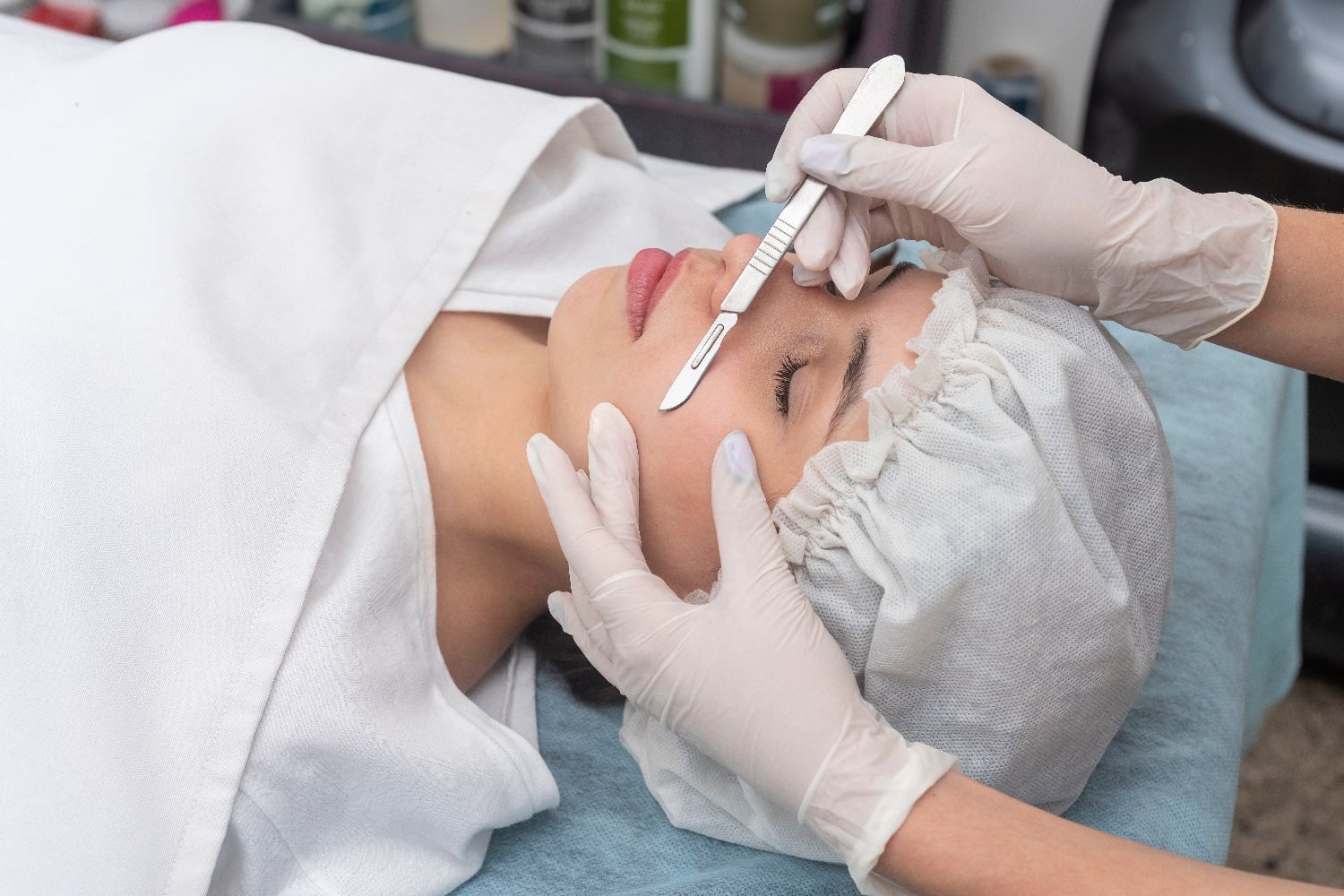 What is Dermaplaning?