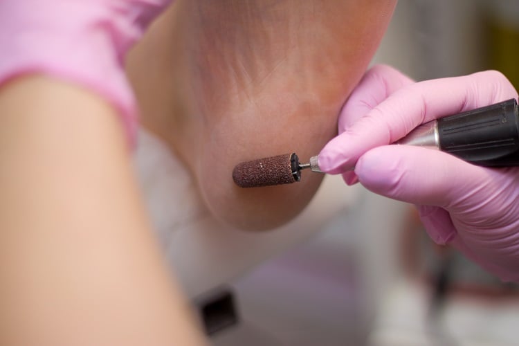 Pedicure using an electric file on the heel