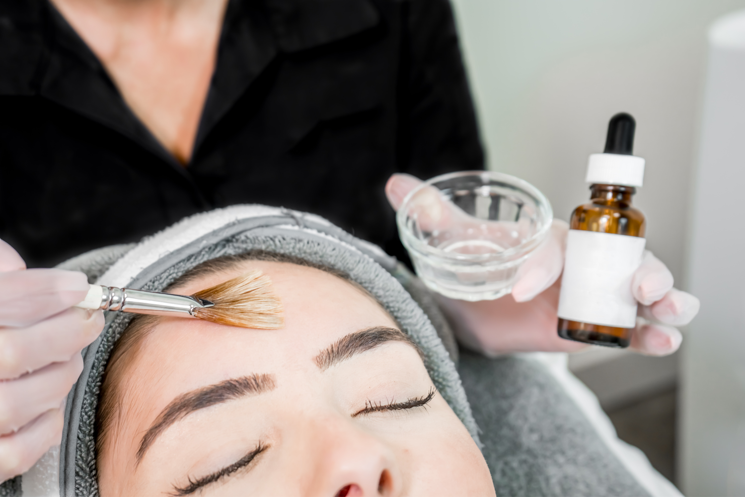 Therapist applying a chemical skin peel